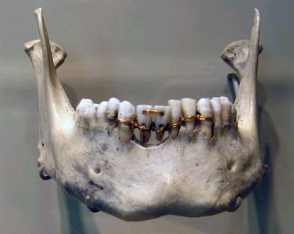 История стоматологии